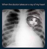 My Chest X-ray